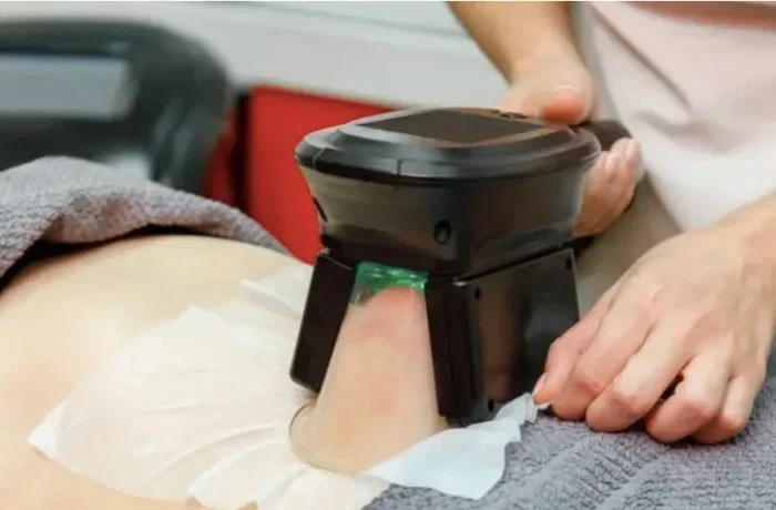 Fedtfrysning