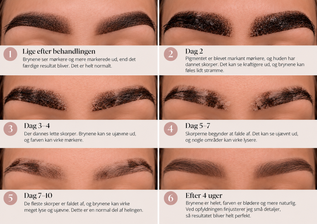 Helingsproces efter permanent makeup af bryn – fem stadier med mørkere pigment, skorpedannelse og helede bryn efter microshading.